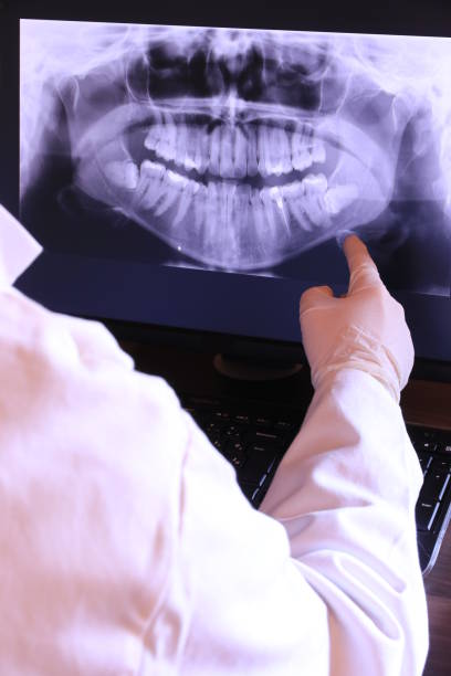Best Emergency Dentist for Special Needs Patients in Lakemore, OH